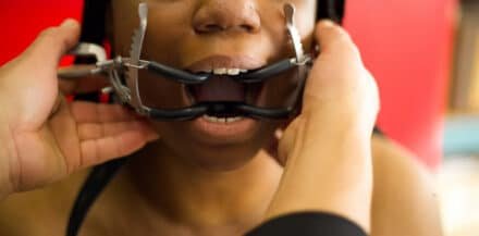 Rubber Coated Whitehead Gag - Image 5